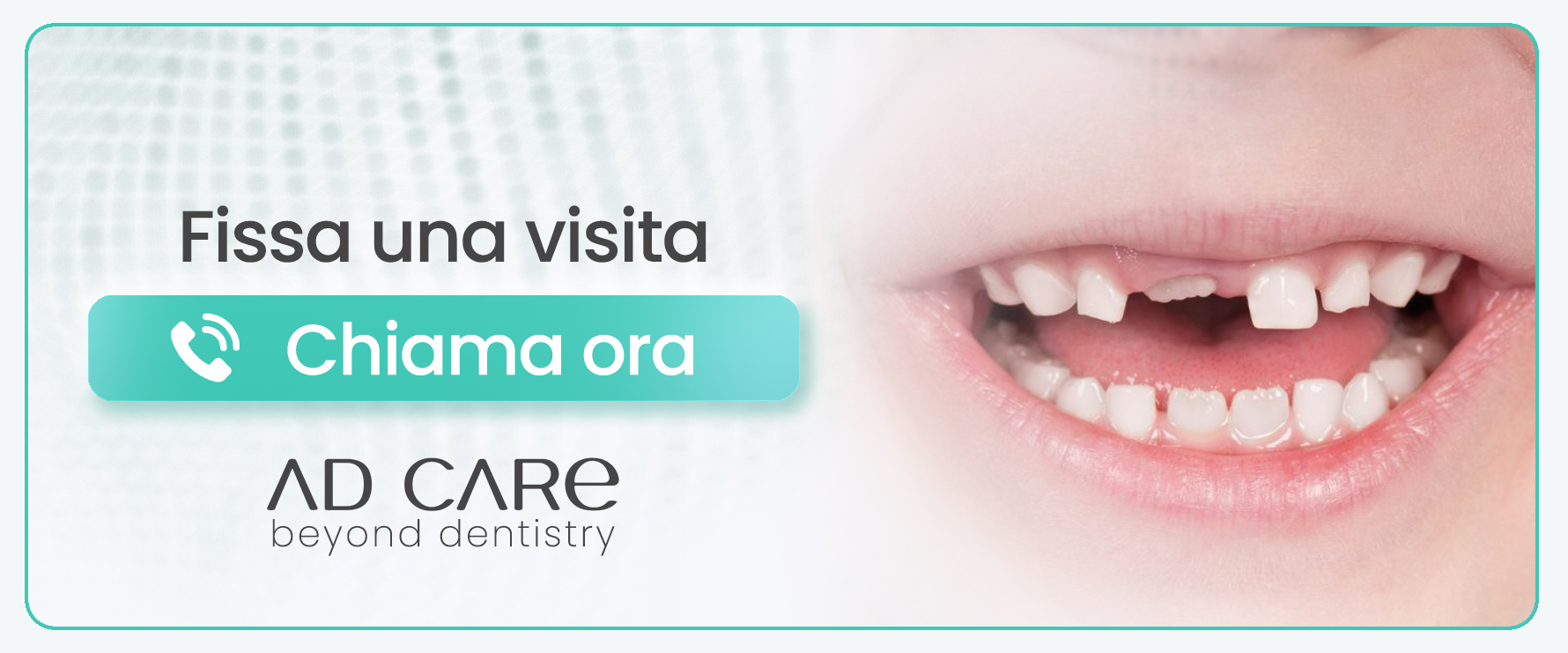 sigillatura-dentale-pediatrica milano centro 
